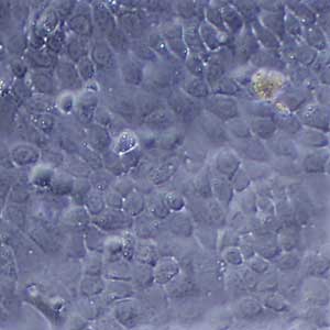 Uninfected human lung epithelial cells.